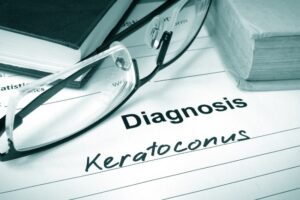 Keratoconus Treatment Fredericksburg